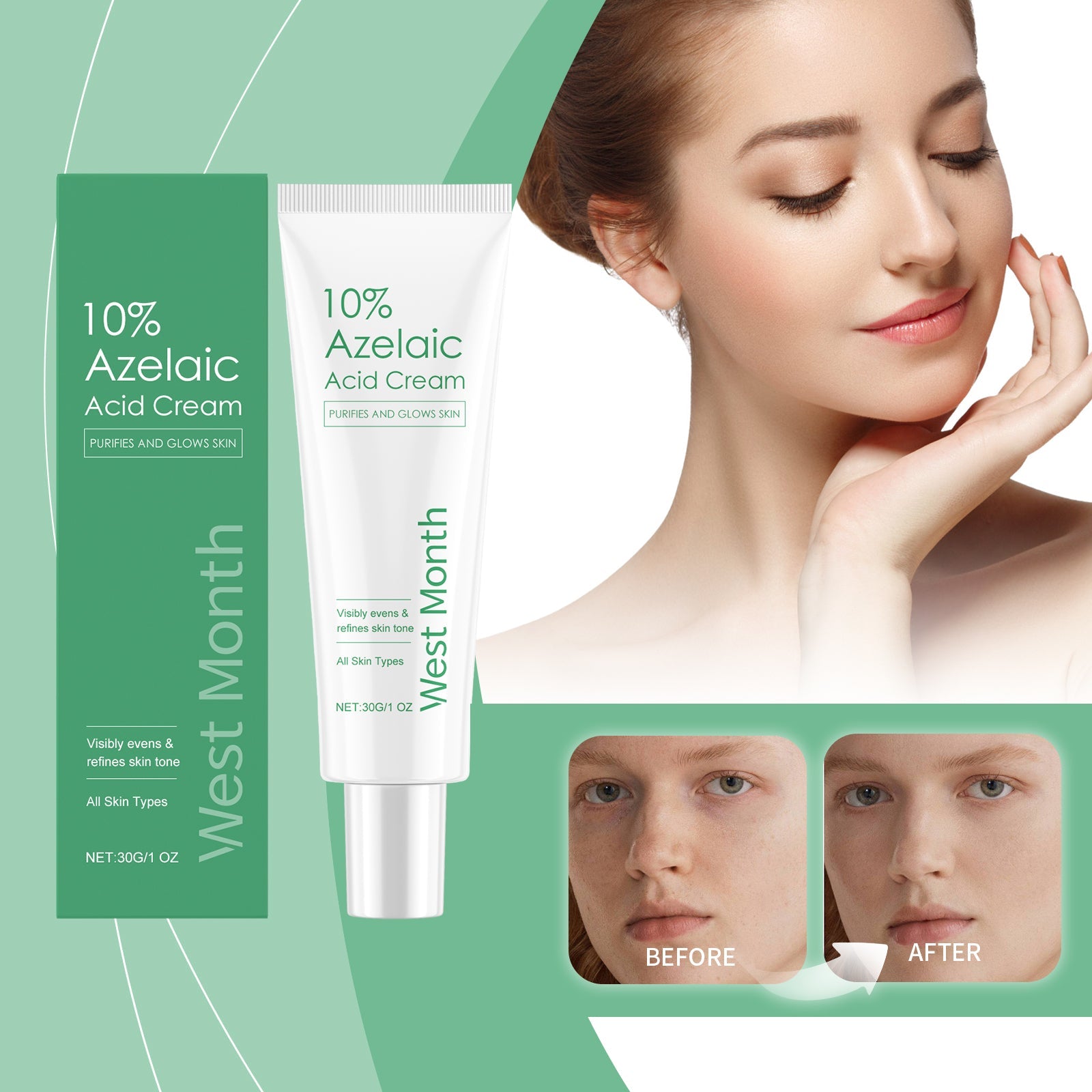 Azelaic Acid Essence Cream for Moisturizing Skin