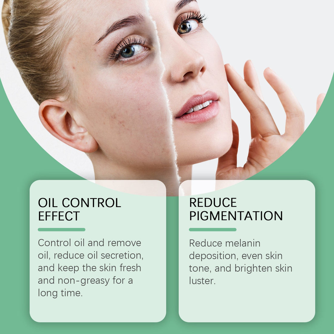 Azelaic Acid Essence Cream for Moisturizing Skin